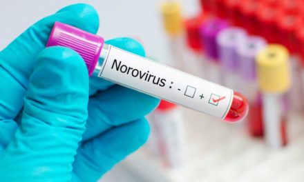 Norovirüs Nedir?
